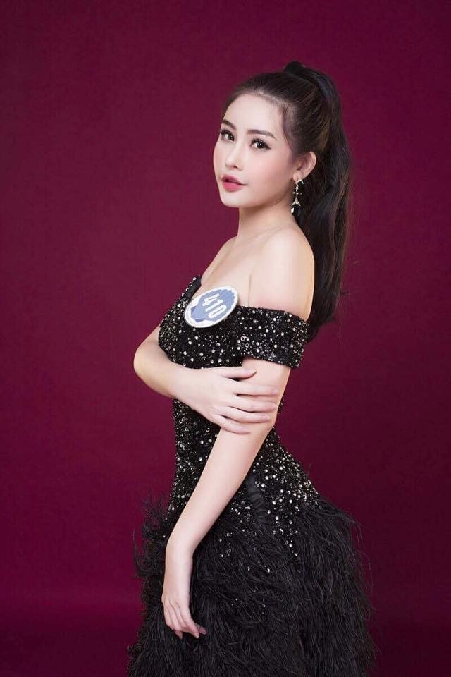 Cuc NTBD len tieng vu Hoa hau Dai duong phau thuat van dang quang-Hinh-2